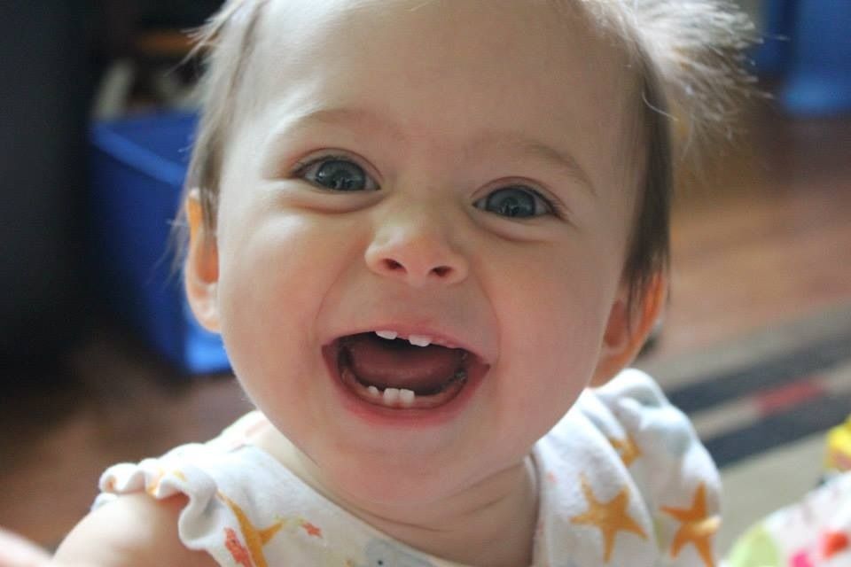 Crooked baby teeth BabyCenter