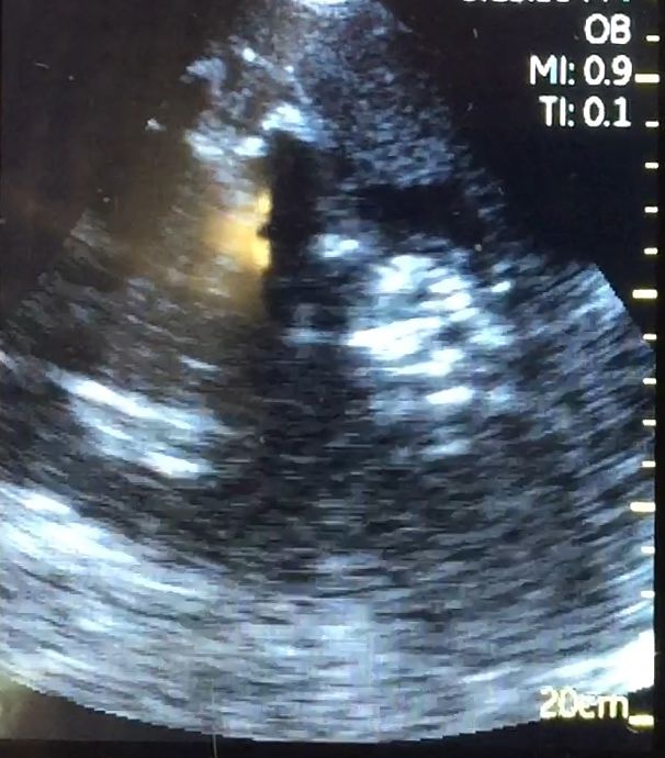  photo ultrasound1_zpsguuuctta.jpg